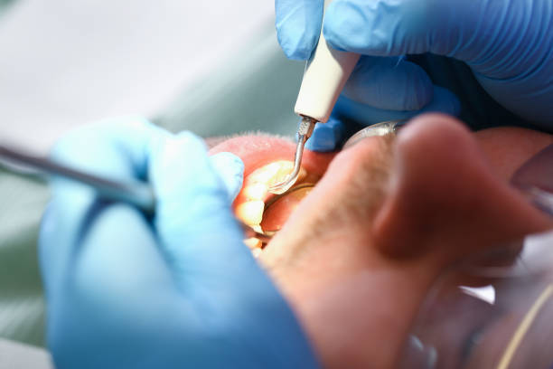 Best Walk-In Emergency Dental Services in Verona, MS