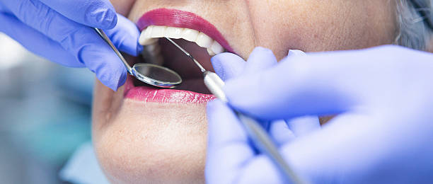 Best Emergency Cosmetic Dentistry (e.g., broken veneers) in Verona, MS